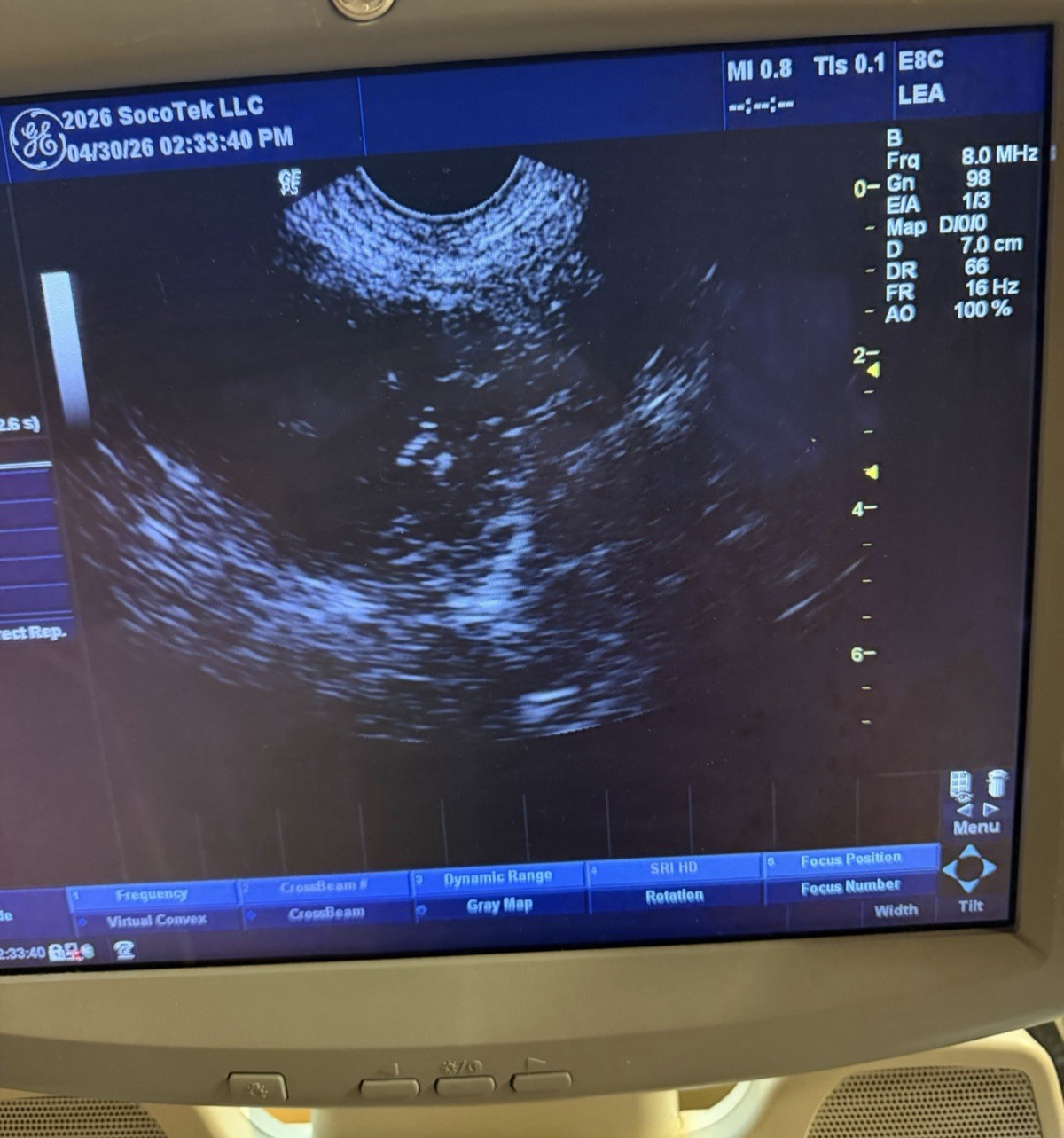 GE Healthcare E8C Endocavitary Ultrasound Probe 2297883 Obstetrics Radiology