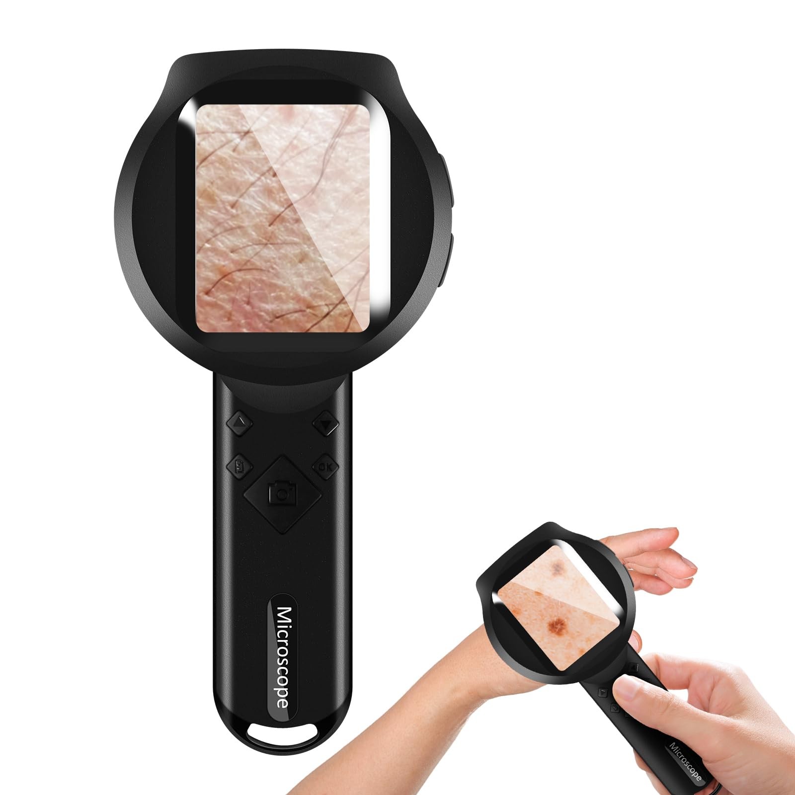 Handheld Dermatoscope, 500X Magnification Skin & Scalp Analyzer for Scalp/Hair