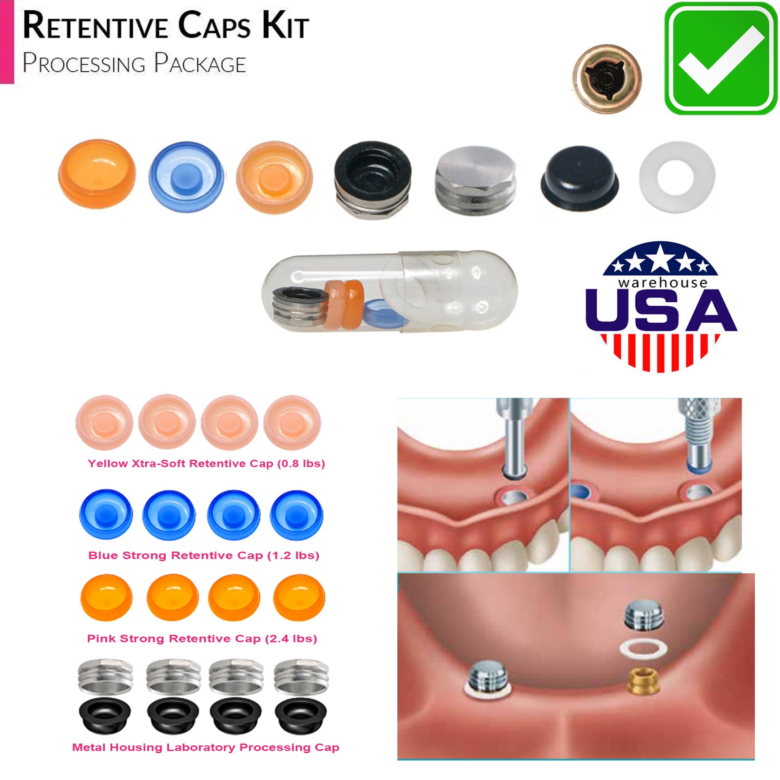 US Locator Accessory For Nobel Dental Core Implant Tool Abutment Cap Replacement
