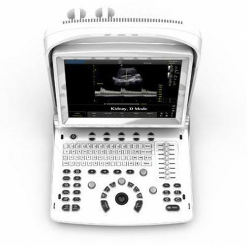 Chison ECO3 Vet Veterinary Ultrasound With Equine Rectal Probe Warranty 3 Years