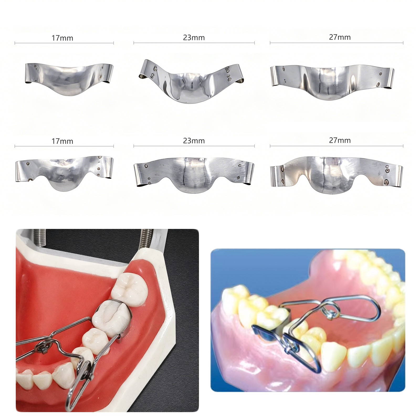 Dental saddle-shaped Matrix Band Fit Garrison Palodent V3 System