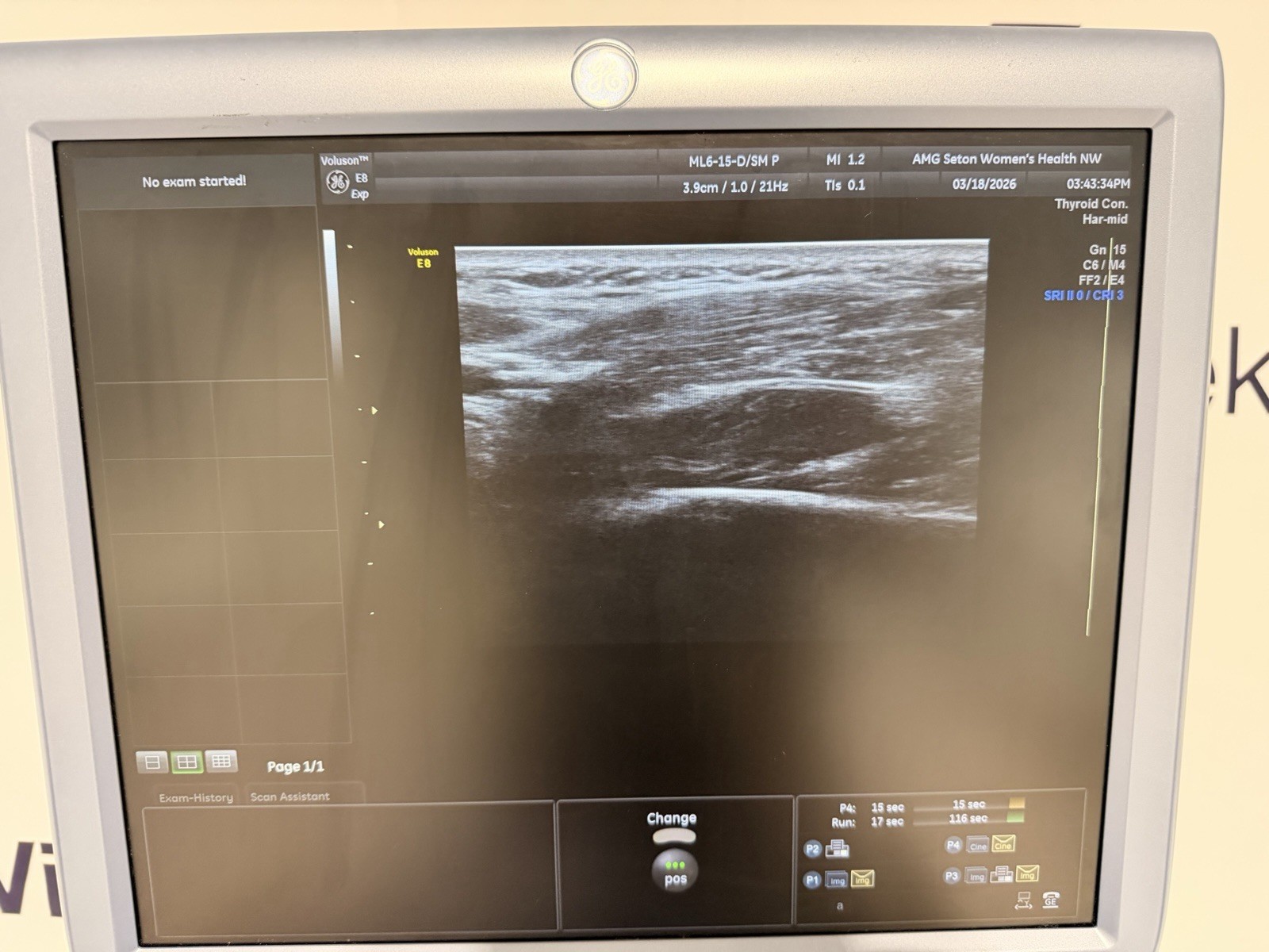GE Voluson E8 Expert Ultrasound | 2 Probes | 4D HDlive | All Options | Warranty
