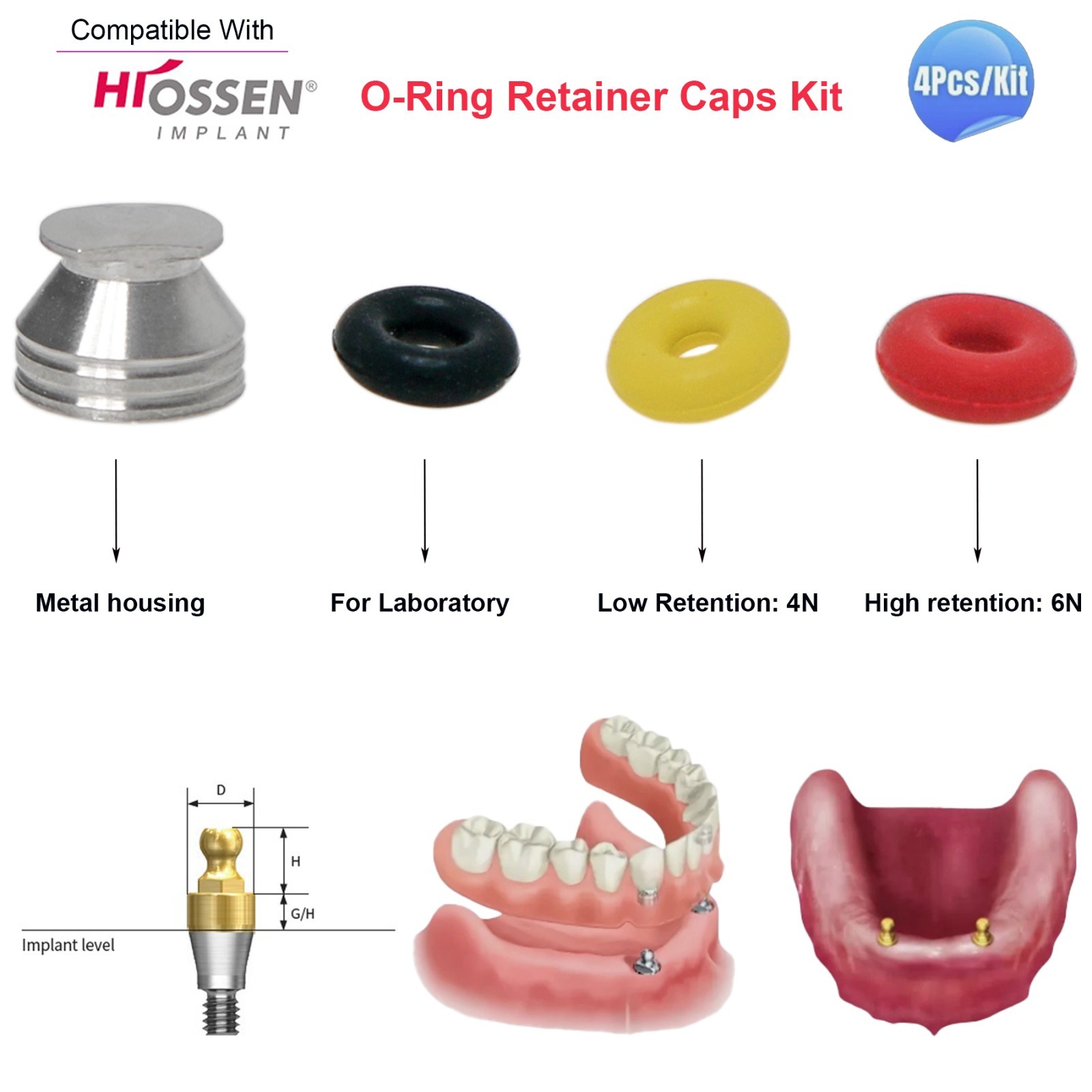 Dental Implant O-ring Retention Cap Kit For Hiossen/Osstem Ball Abutment 4pc/set