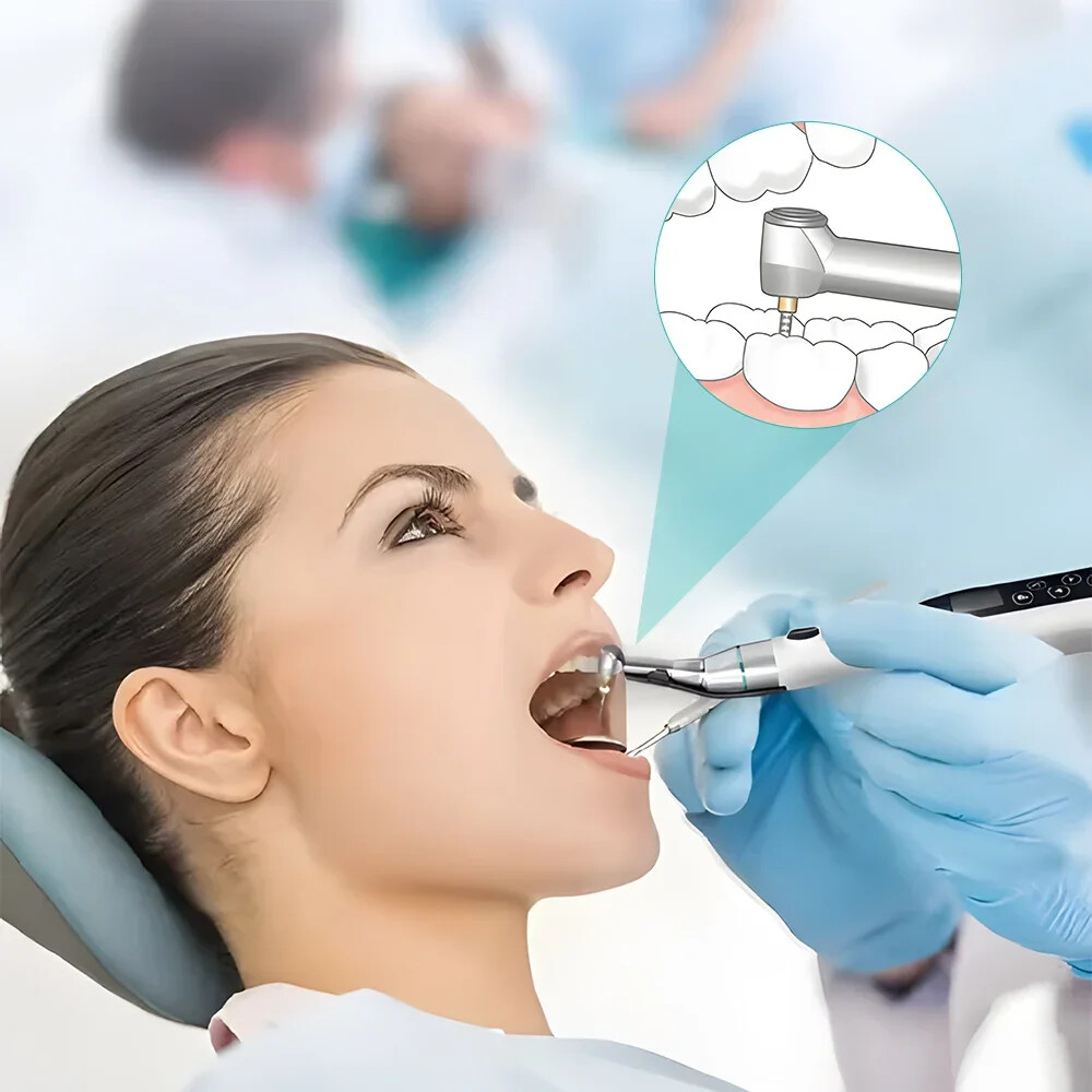 Dental Wireless LED Endo Motor 16:1 Contra Angle Handpiece Root Canal Treatment