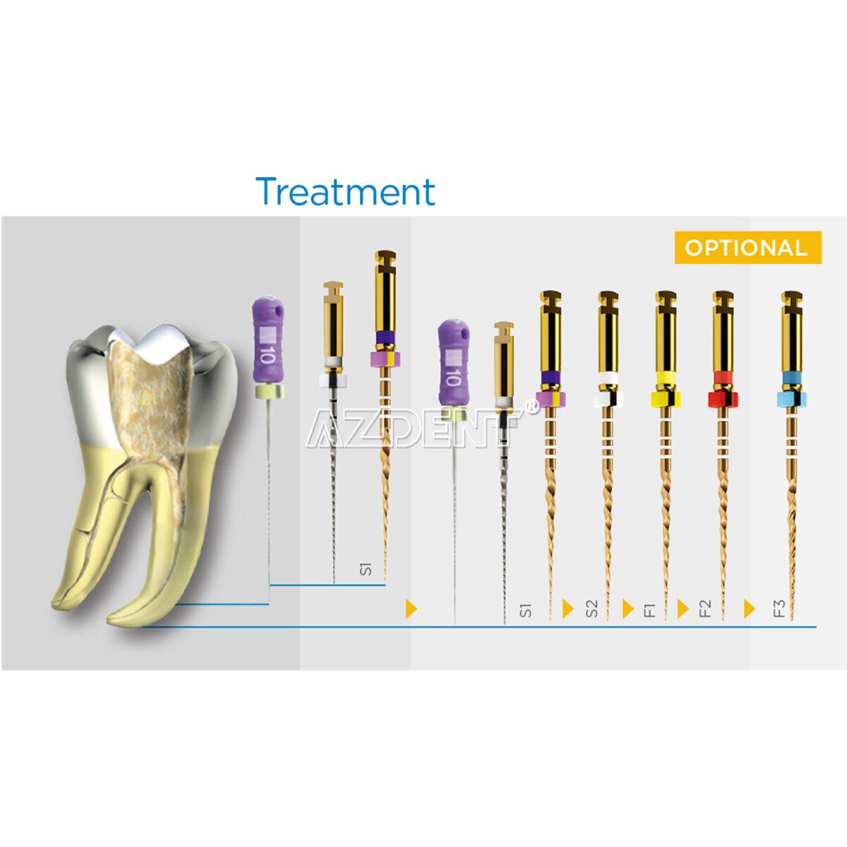 Limas rotatorias NITI para endodoncia dental Uso del motor Gold Taper SX-F3 25mm