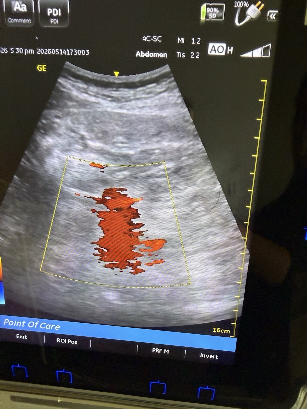 GE Venue 40 Portable Ultrasound Machine w/ 2 Probes + Docking cart 2014