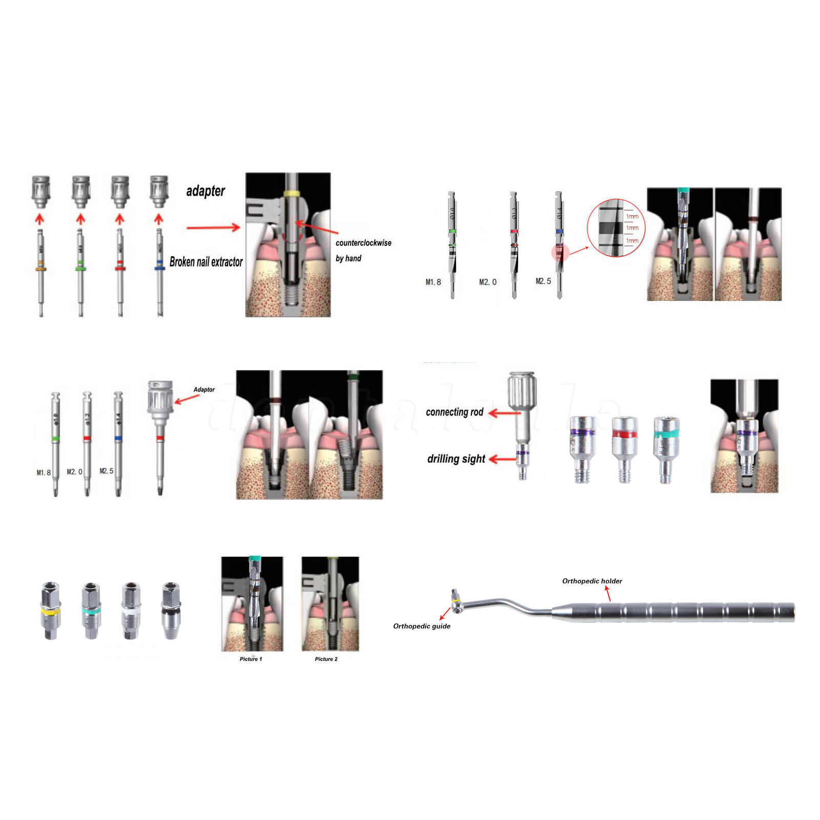 Dental Implant Fixture & Broken Screw Removal Kit Remove Surgical Tool Remover