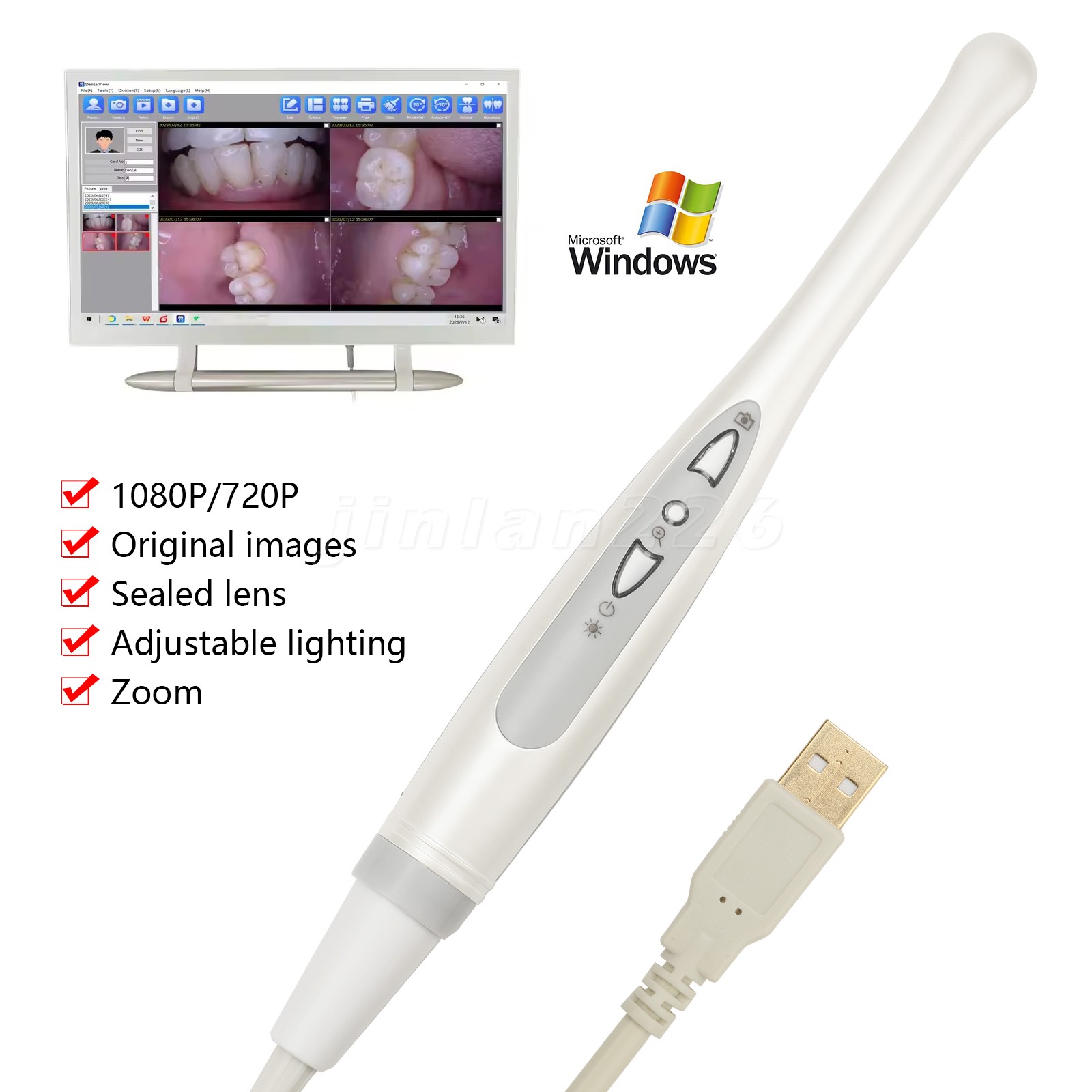 USB Dental Intraoral Oral Camera 1/4 sony CCD Fit TWAIN