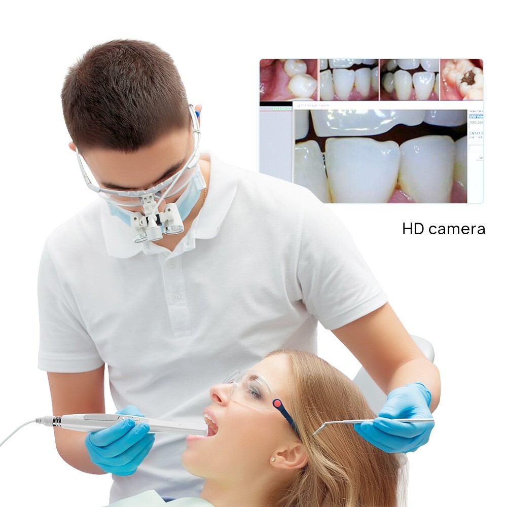 USB Dental Intraoral Camera USB Digital Imaging Intra Oral images Oral Endoscope