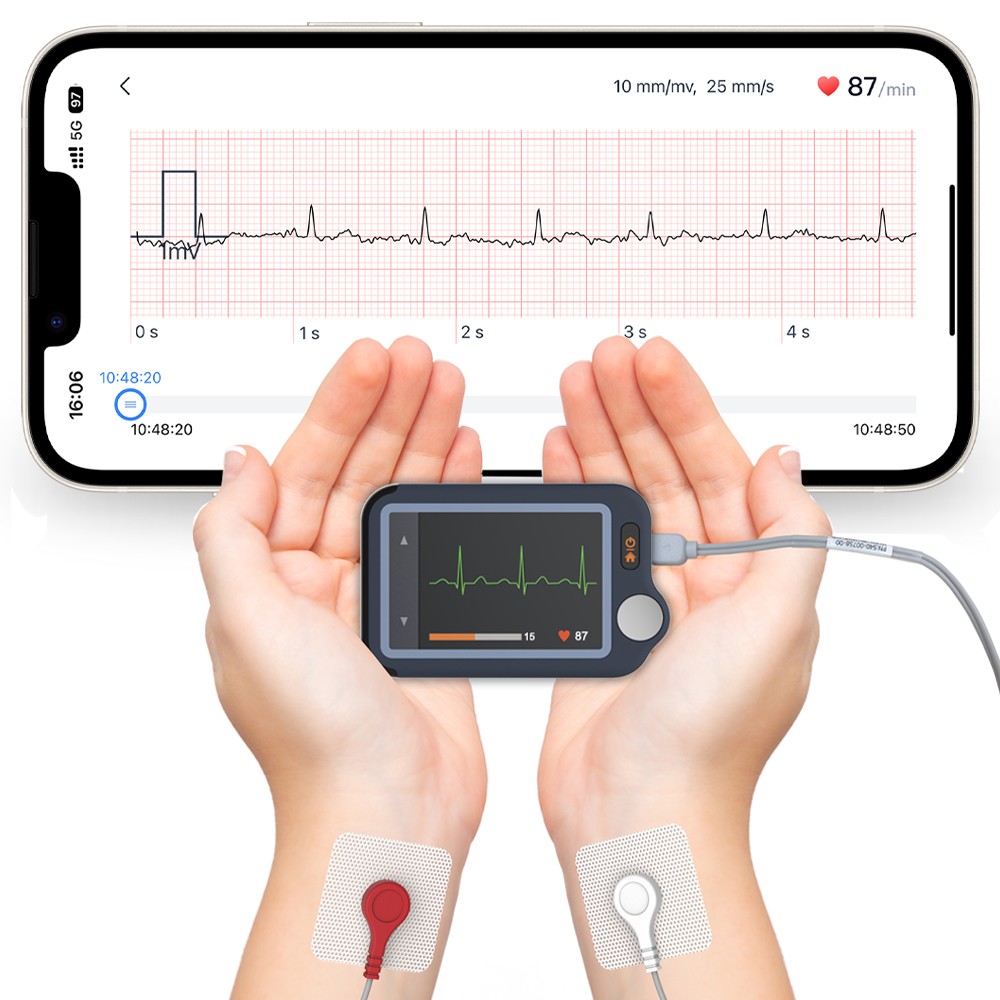 Home EKG Monitor with External Cable, 30s/60s/5min Recording + AI ECG Analysis