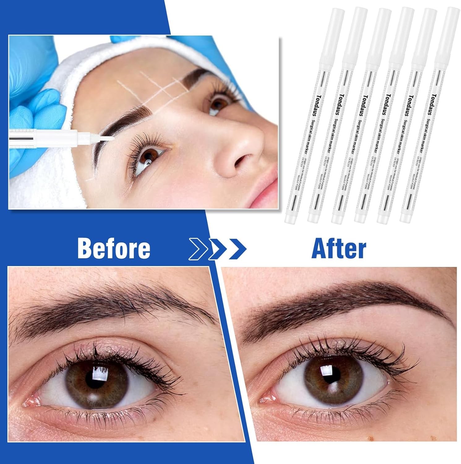 6Pcs Professional Surgical Tip Skin Marker Pen White Stencil Markers Pen with