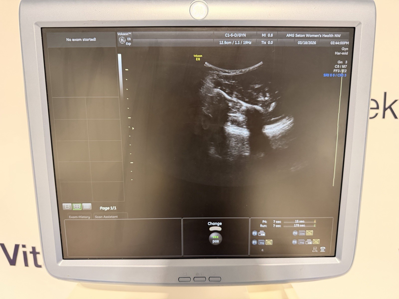 GE Voluson E8 Expert Ultrasound | 2 Probes | 4D HDlive | All Options | Warranty