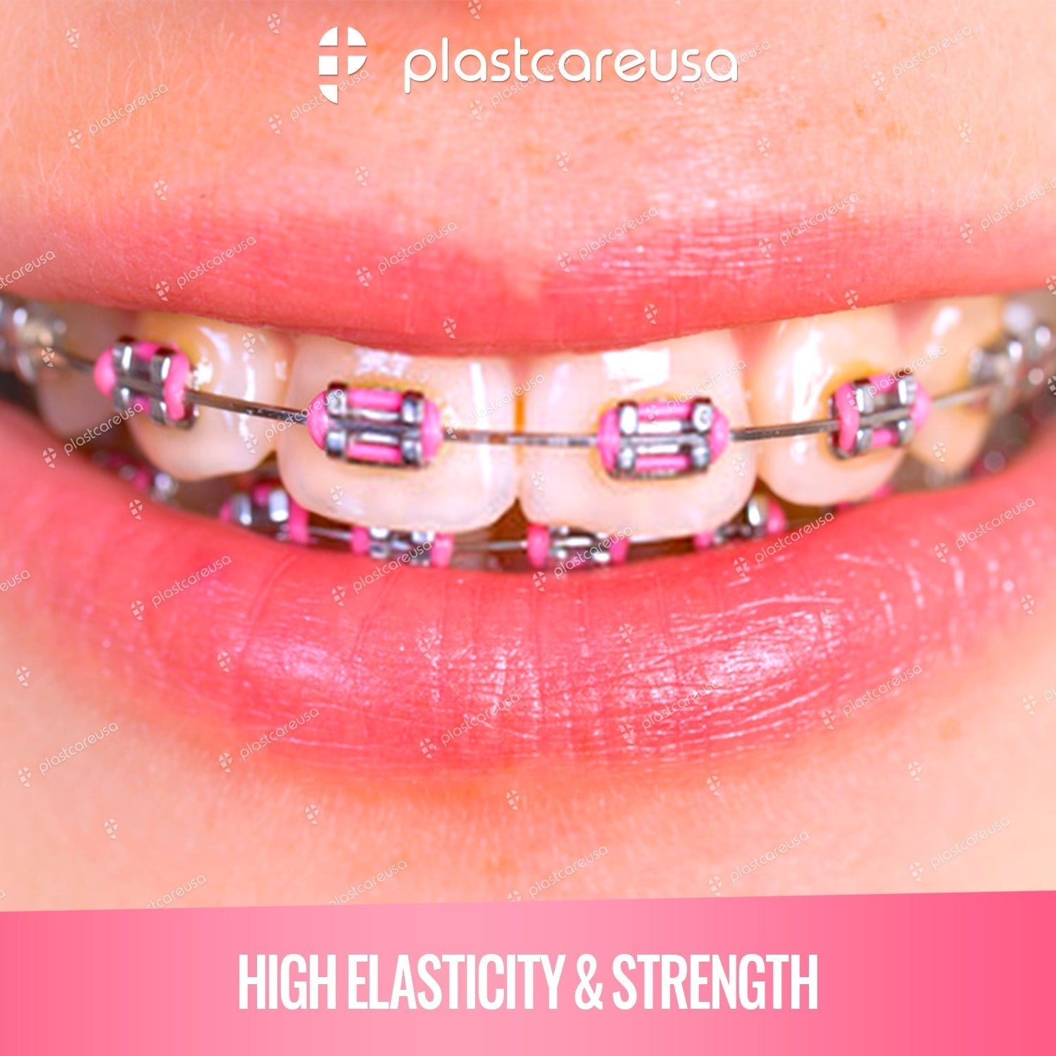 4,160 Pink Dental Ligature Ties, Rubber Bands, Braces Teeth Brackets, 4 Bags