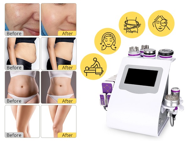 9in1 Beauty Machine for Body Massage Facial Skin Care Boost Contour Lost Weigk8