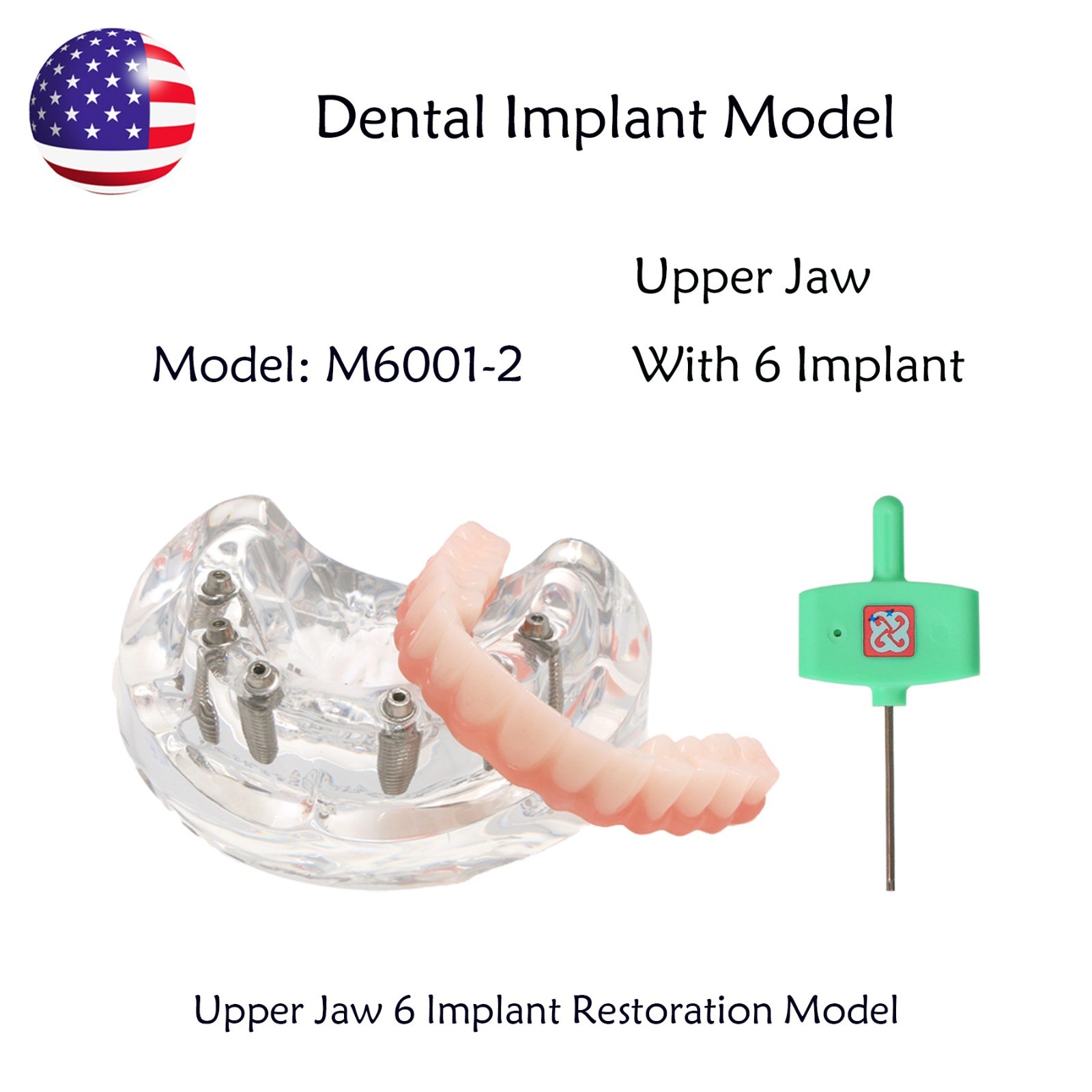 US Dental Implant Overdenture Model All-on-4/6 Upper Jaw Restoration 4/6 Screws