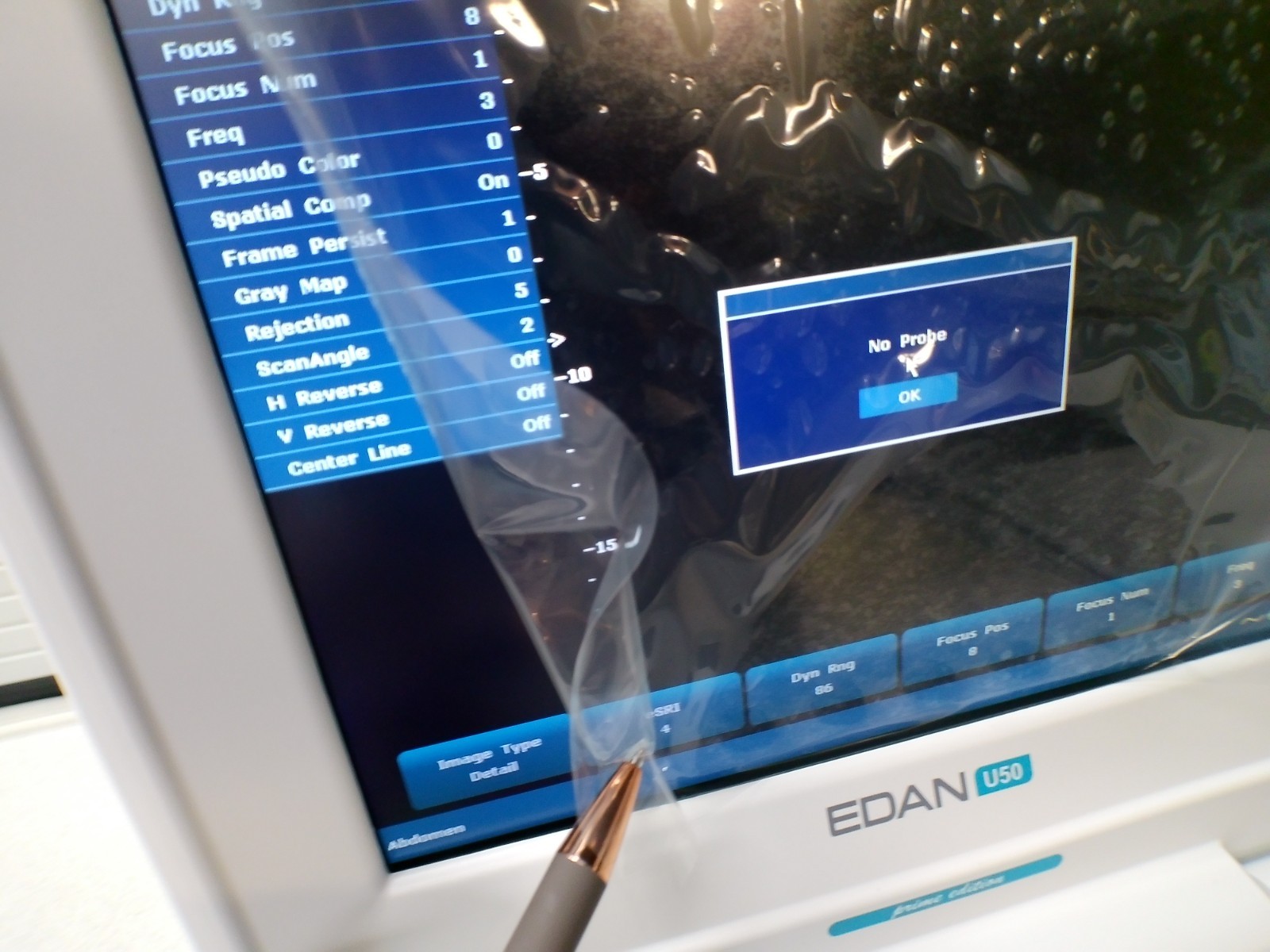 Edan U50 prime edition Diagnostic Ultrasound