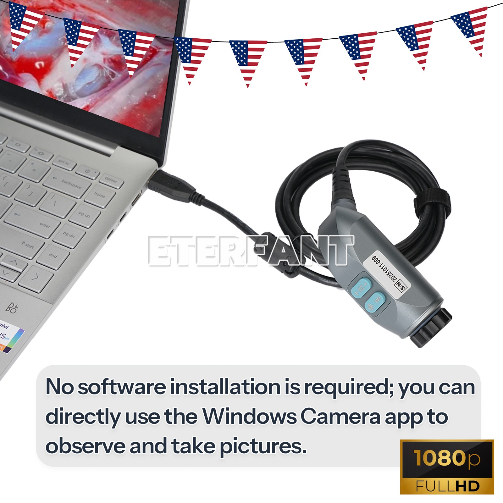 USB 1080p Full HD ENT Surgery & Inspection Endoscopy Laparoscopic Camera TU-U1
