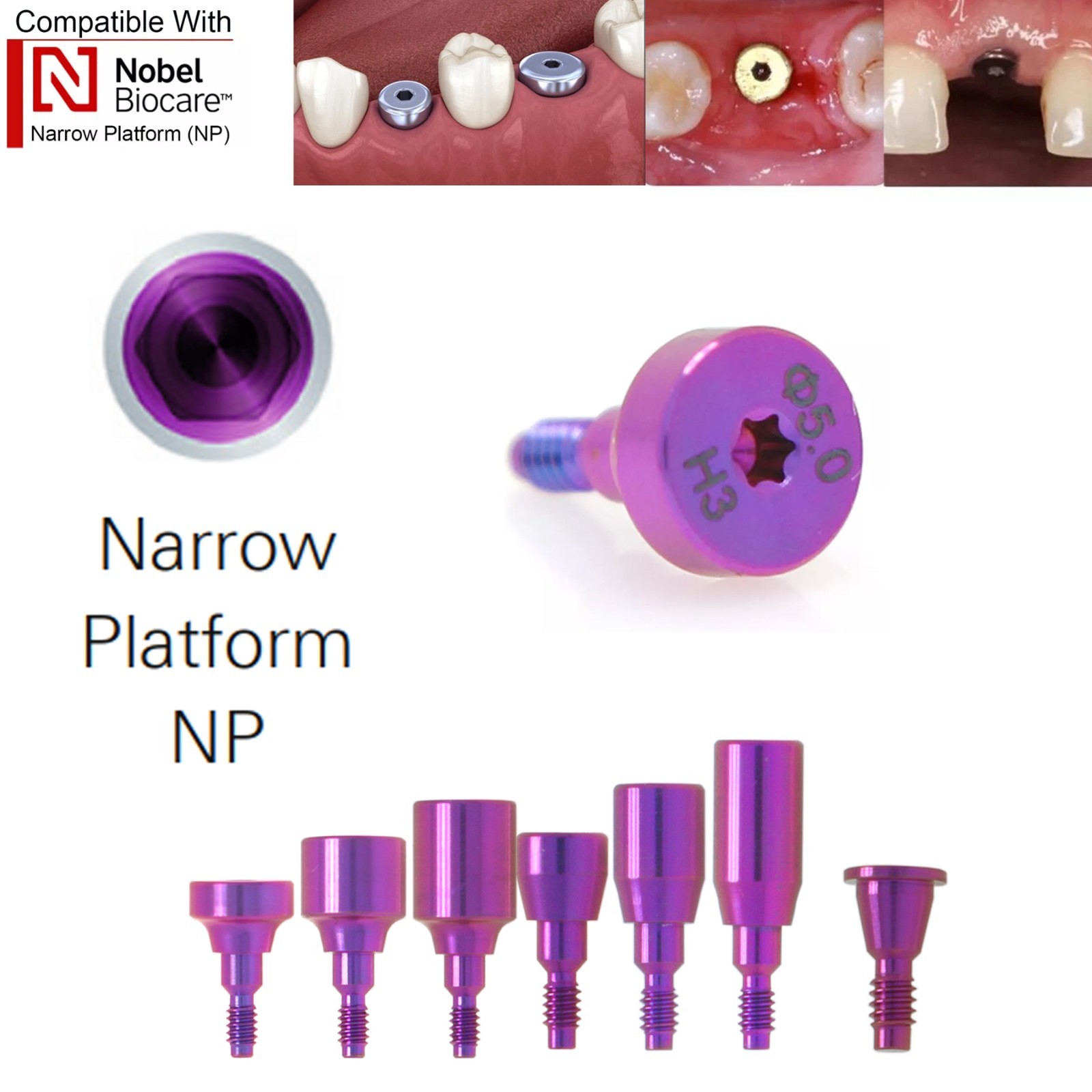 5Pcs Dental Healing Abutment Cap NP Internal conical Fits Nobel Biocare Ø3.6/5mm