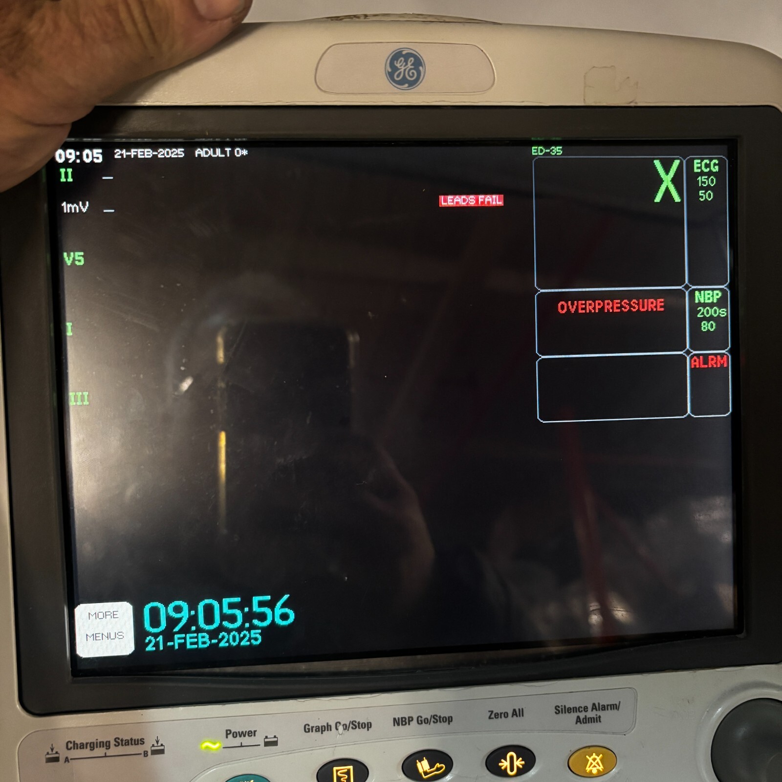 GE Dash 4000 Patient Monitor Vital Signs Display ECG NIBP SpO2 100-240V ✅
