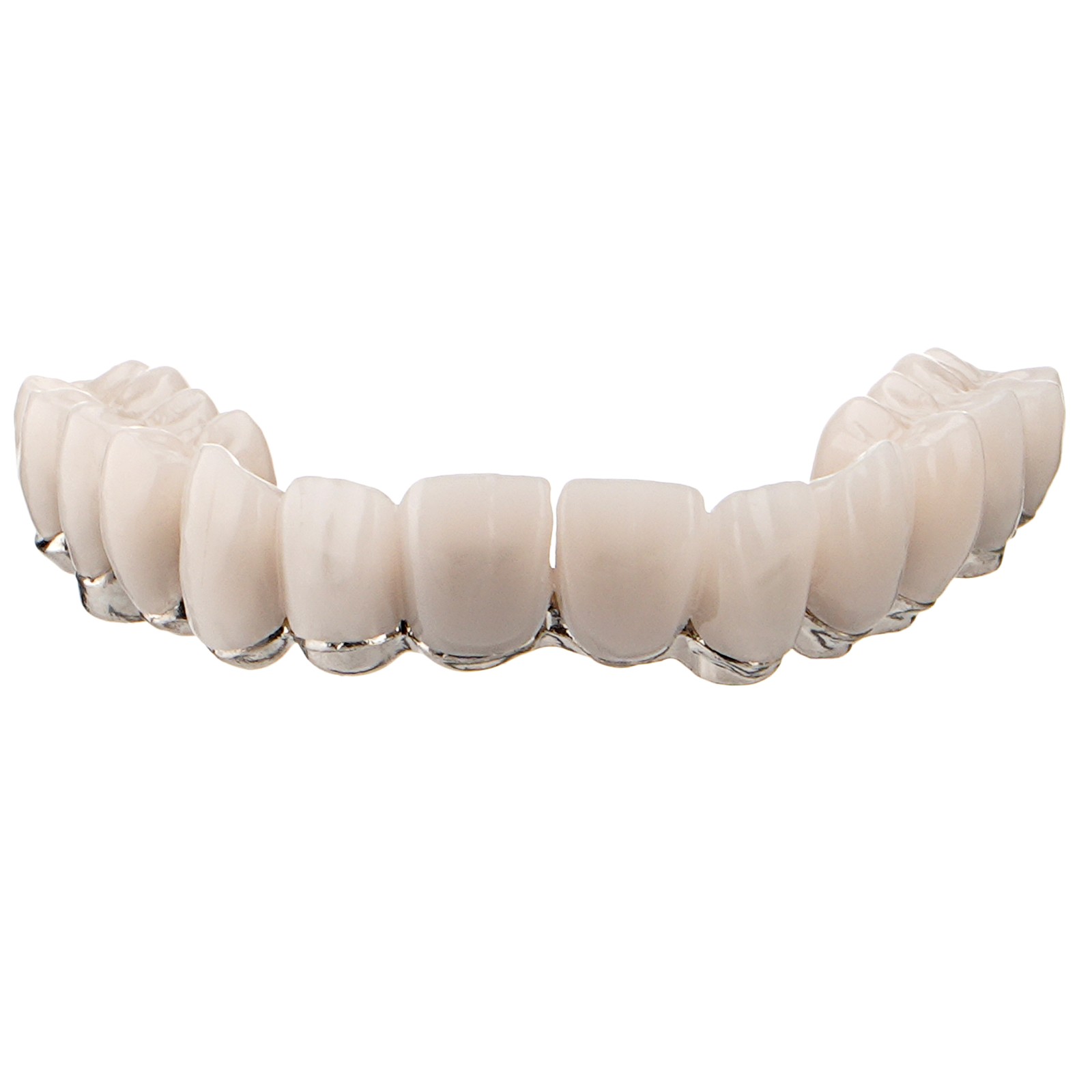Dental All-on-4 Overdenture Model Dental Upper Jaw Implants Restoration 4 Screws