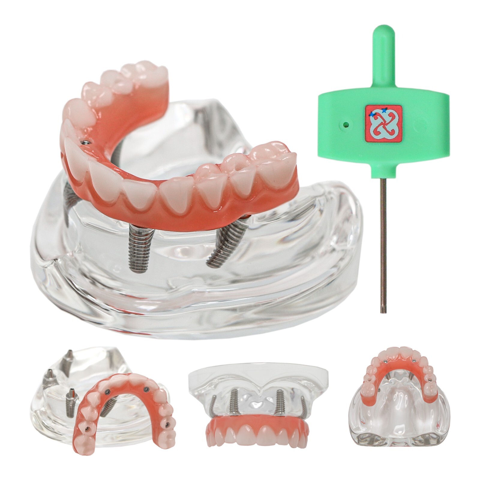 Dental All-on-4 Overdenture Implant Model, Upper/Lower Jaw-Clear,With 4 Screw