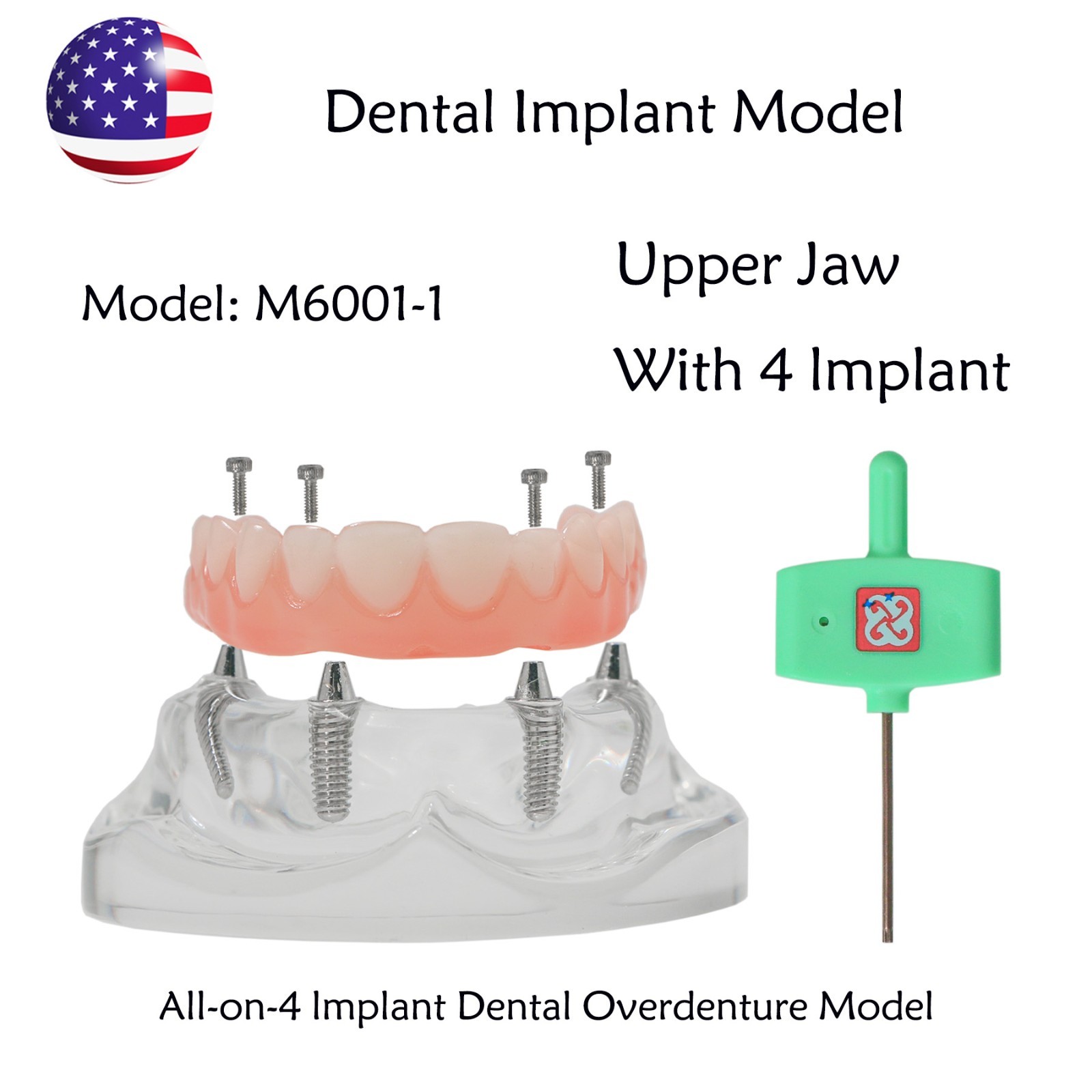 US Dental Implant Overdenture Model All-on-4/6 Upper Jaw Restoration 4/6 Screws
