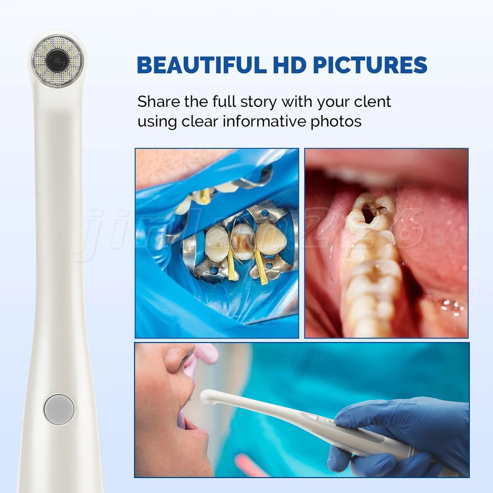 Dental HD Intraoral Camera USB Digital Imaging Work on Dexis/Eaglesoft