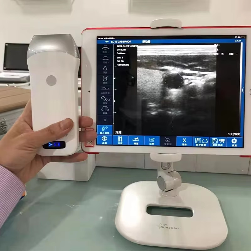 Wireless Ultrasound Probe Scanner Portable Machine Support iOS Android Windows