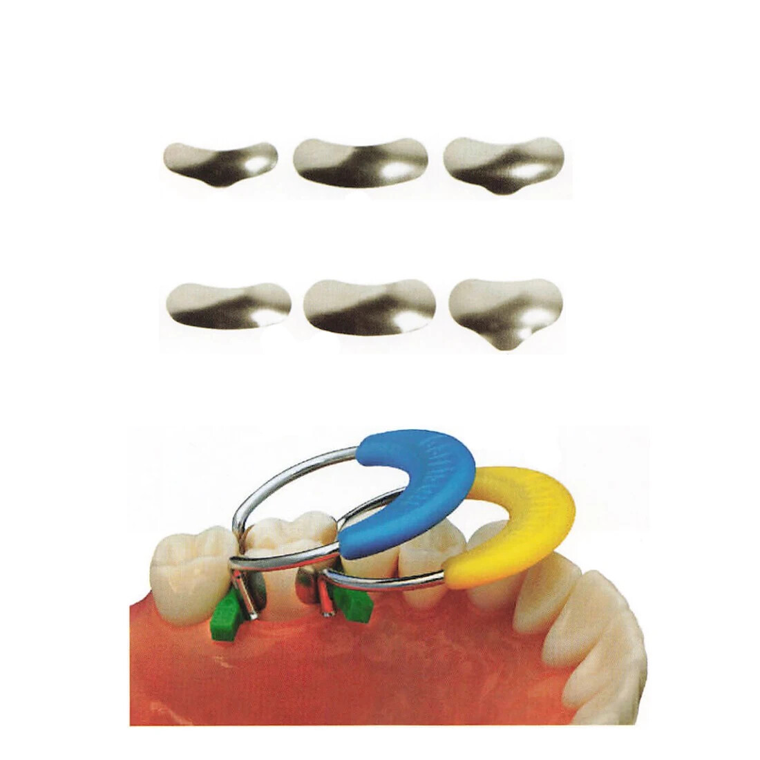 50Pcs Dental Metal Matrices Sectional Contoured Matrix Refill S/M/L EASYINSMILE