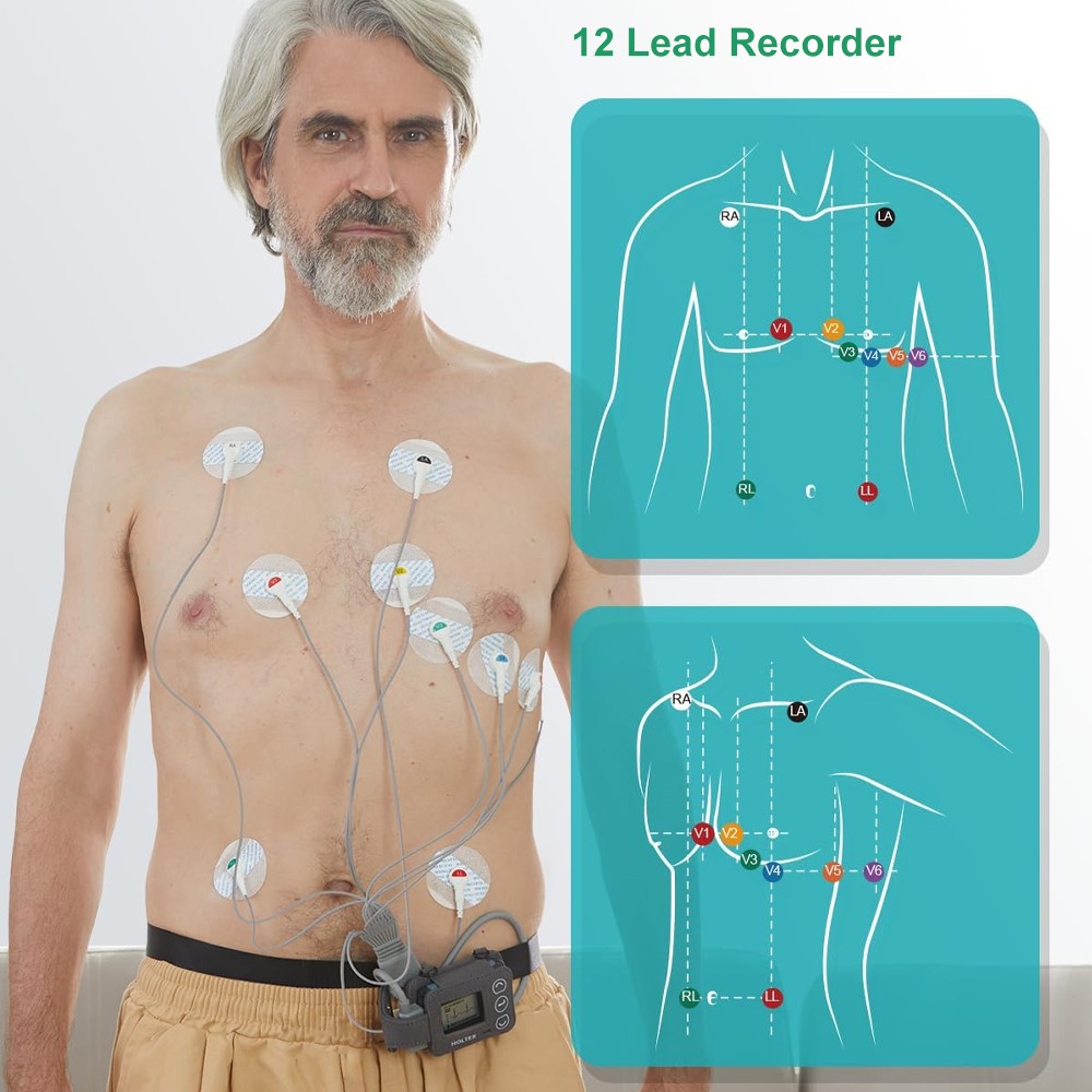 12 lead Holter Monitor 24h Portable with AI analysis software for Mac & Windows