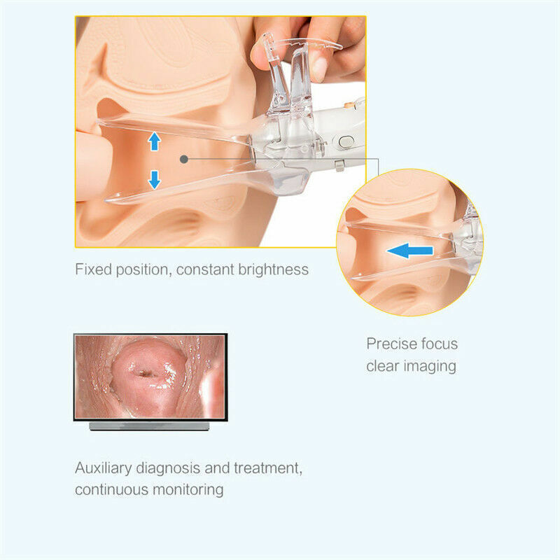 Digital Video Electronic Mini Colposcope FA2 3000000 Pixels Camera NewbK