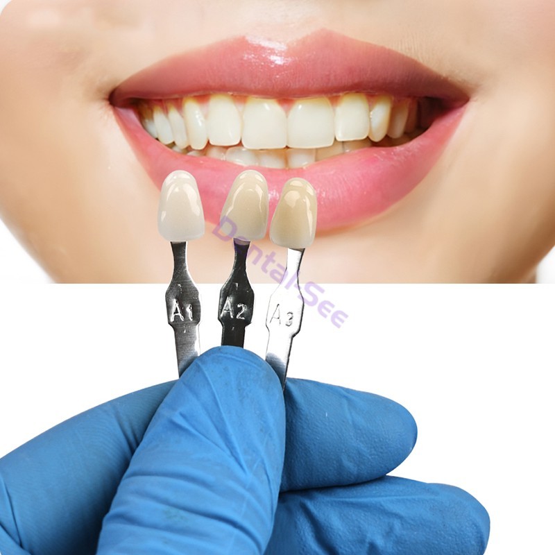 Vita Classical Shade Guide Dental Materials A1-D4 16 Colors Teeth Whitening USA