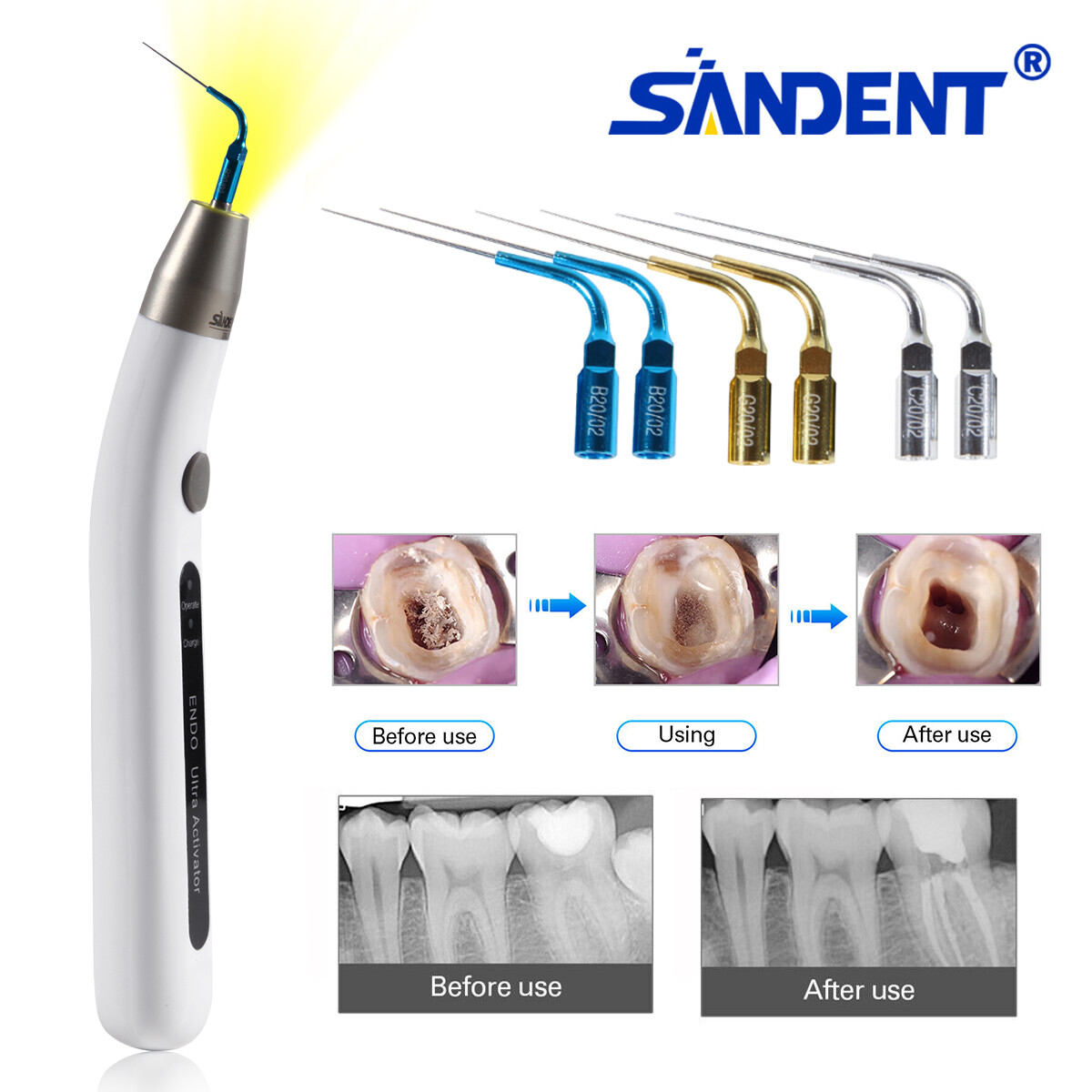 Endo Ultra Activator Dental Ultrasonic Root Canal Irrigator Handpiece 6 Tips DL