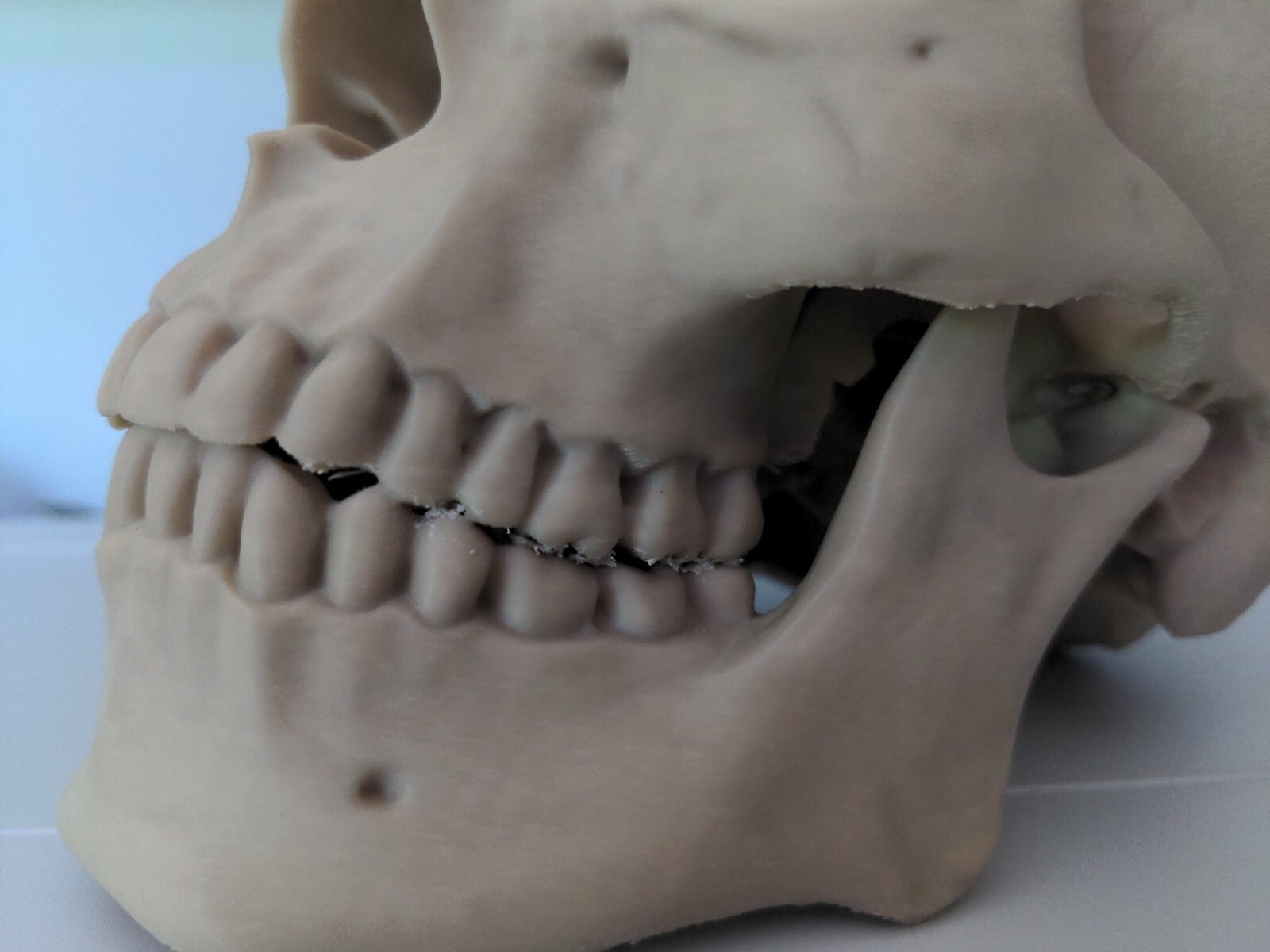 Anatomically Correct Human Skull 3d Printed!