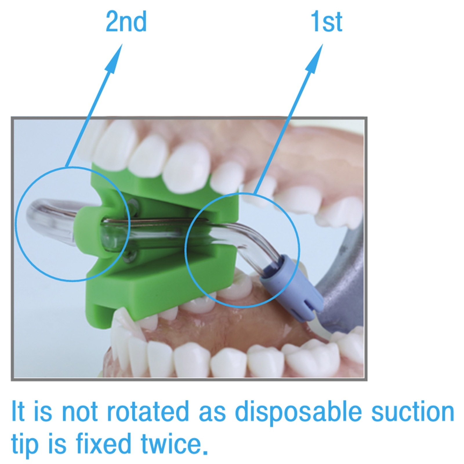 Medium Mouth Prop Autoclavable Osung -MPM (#1244)