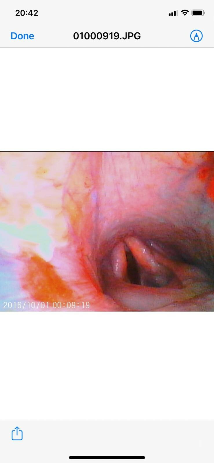 Economy Veterinary Airway Equine Video Endoscope Iphone Android Scope 8mm 100cm