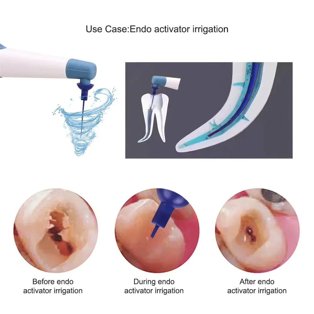 Dental Endo Activator Endodontic Root Ultrasonic Irrigator Root Canal+60pcs Tips