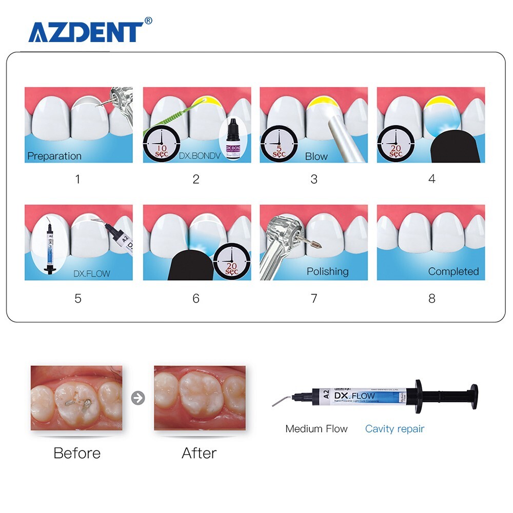 Dental DX.FLOW DENTEX Flowable Medium Flow Light Cure Composite Resin 3g/Kit A2