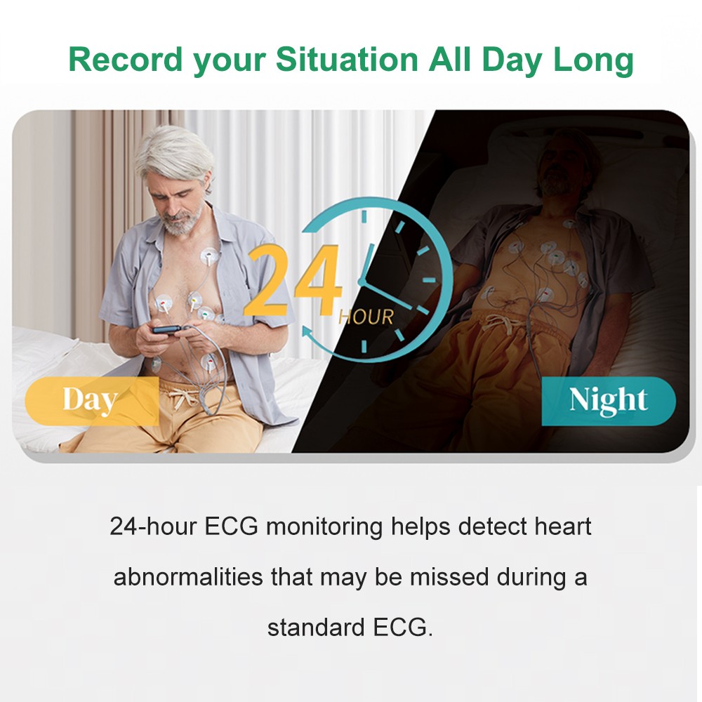 12 lead Holter Monitor 24h Portable with AI analysis software for Mac & Windows