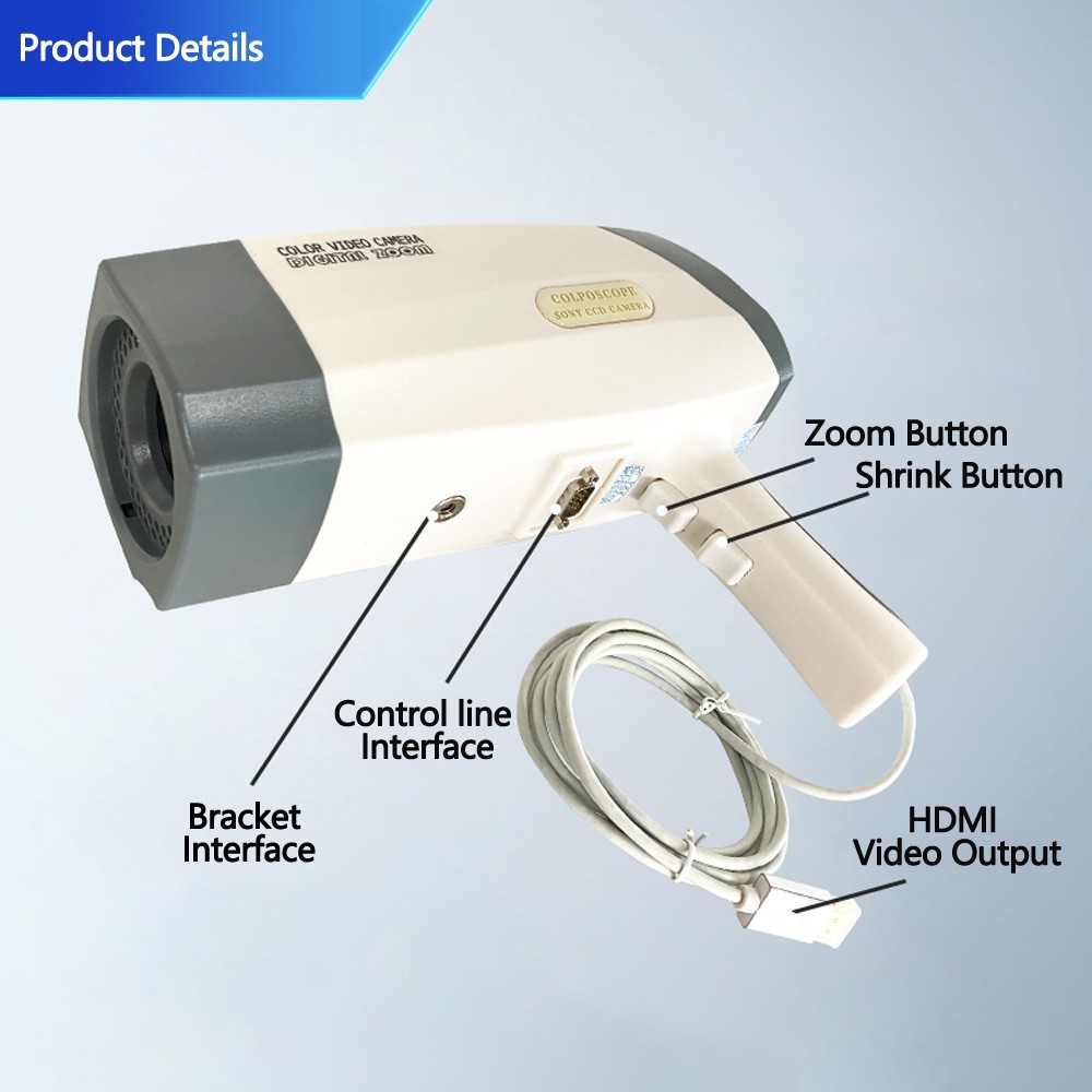 Electronic Digital Colposcope – Gyn, LCD Display & Diagnosis Software