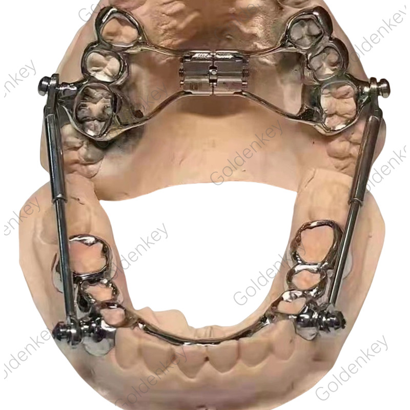 Dental Herbst Appliance Set Device Orthodontic Class II Corrections Dentaurum