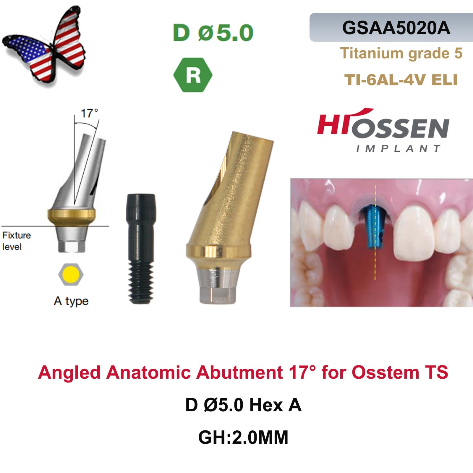 US 17° Angulated Abutment Regular Hex A/B Type For Osstem TS Regular Platform Ti