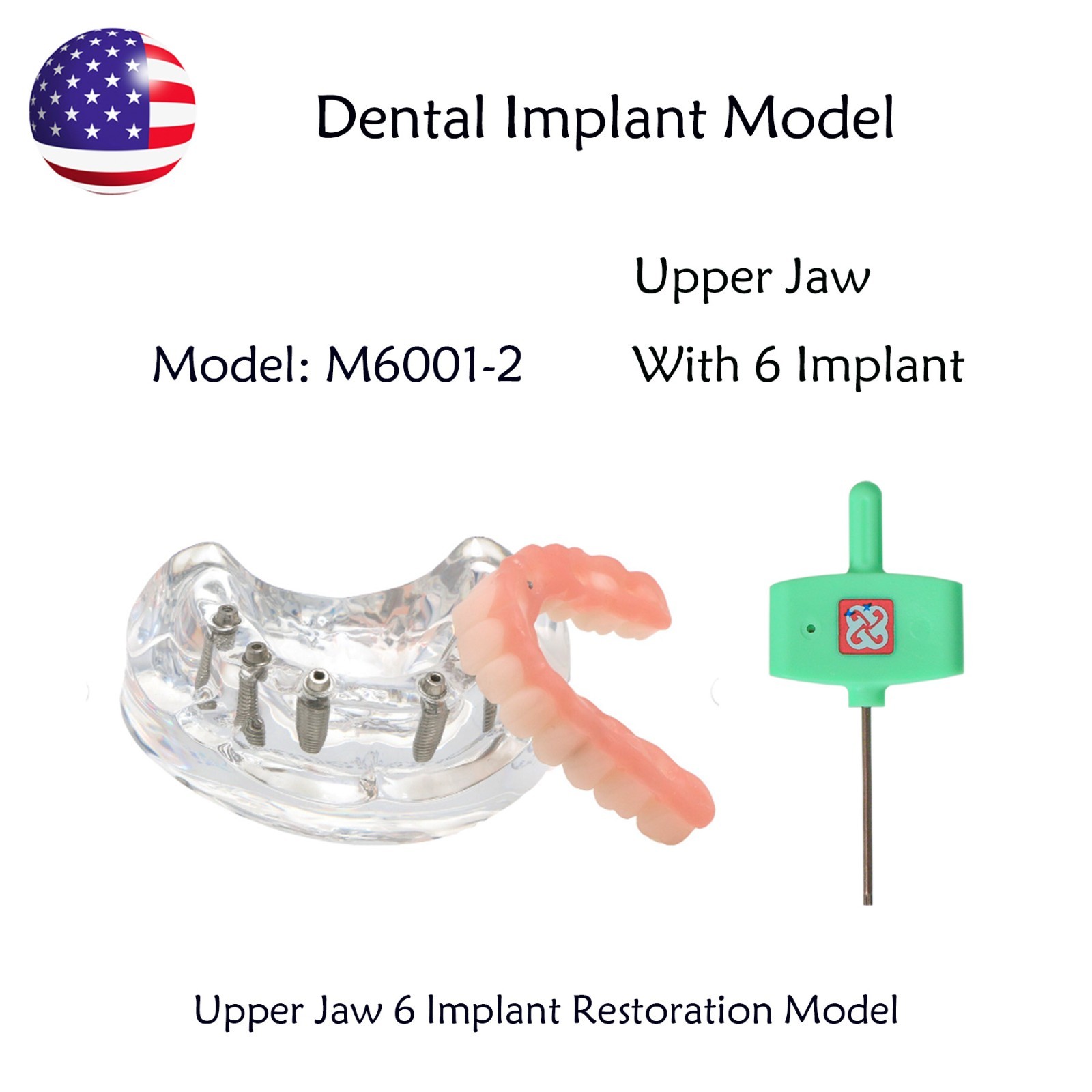 US Dental Implant Overdenture Model All-on-4/6 Upper Jaw Restoration 4/6 Screws