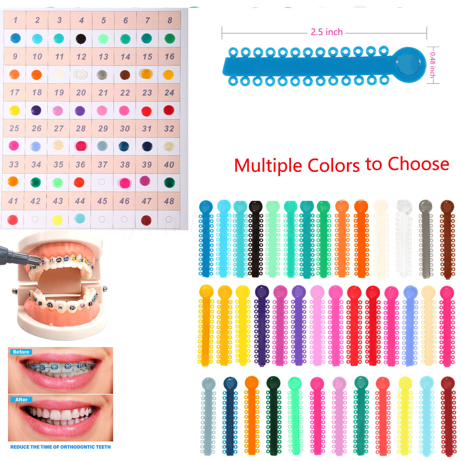 1040pcs Dental Orthodontic Ligature Ties Braces Elastic Rubber Bands 47 Colors
